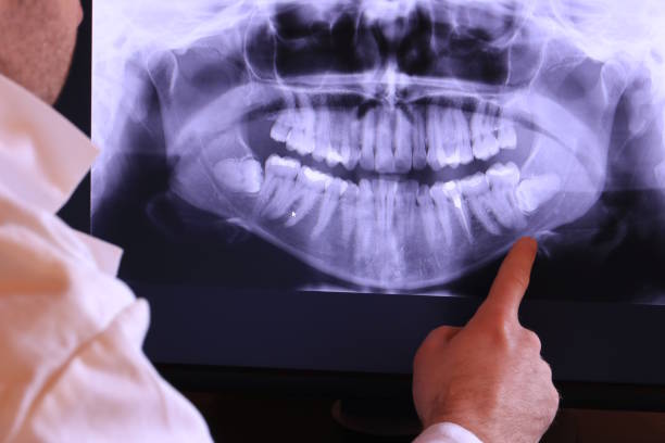 Best Dentist for Tooth Abscess  in Saegertown, PA